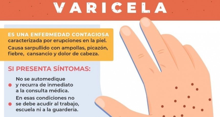 BROTE DE VARICELA EN CAMPANA